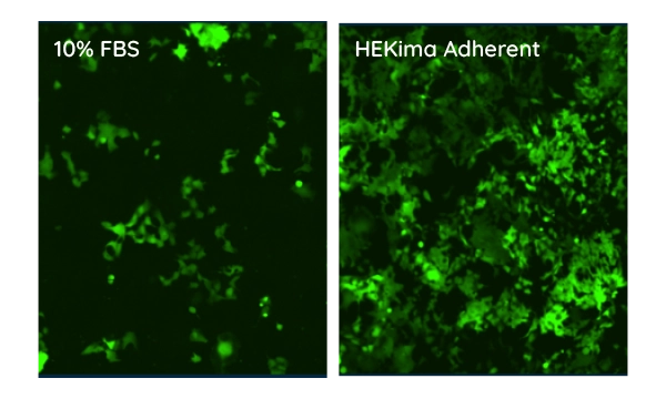 HEKima Adherent HEK cell culture media significantly improves transduction efficiency and protein expression